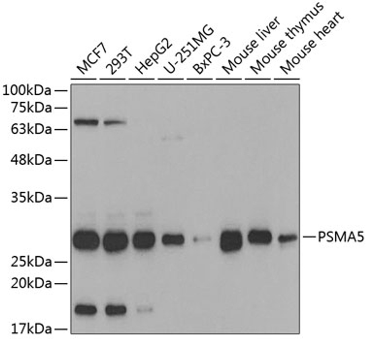 Western blot analysis of extracts of various cell lines, using PSMA5 antibody (19-834) at 1:1000 dilution.<br/>Secondary antibody: HRP Goat Anti-Rabbit IgG (H+L) at 1:10000 dilution.<br/>Lysates/proteins: 25ug per lane.<br/>Blocking buffer: 3% nonfat dry milk in TBST.