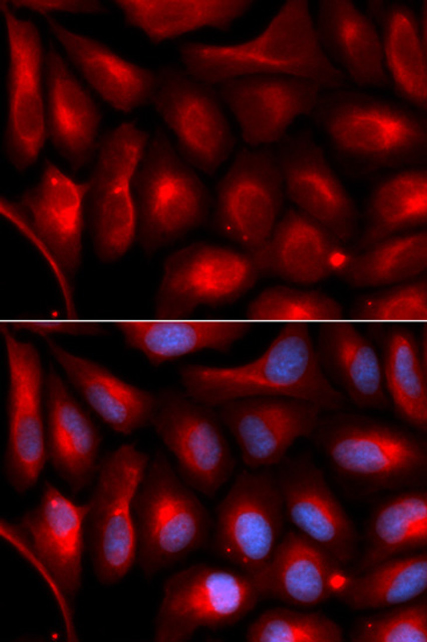 Immunofluorescence analysis of U2OS cells using PSMA5 antibody (19-834) . Blue: DAPI for nuclear staining.