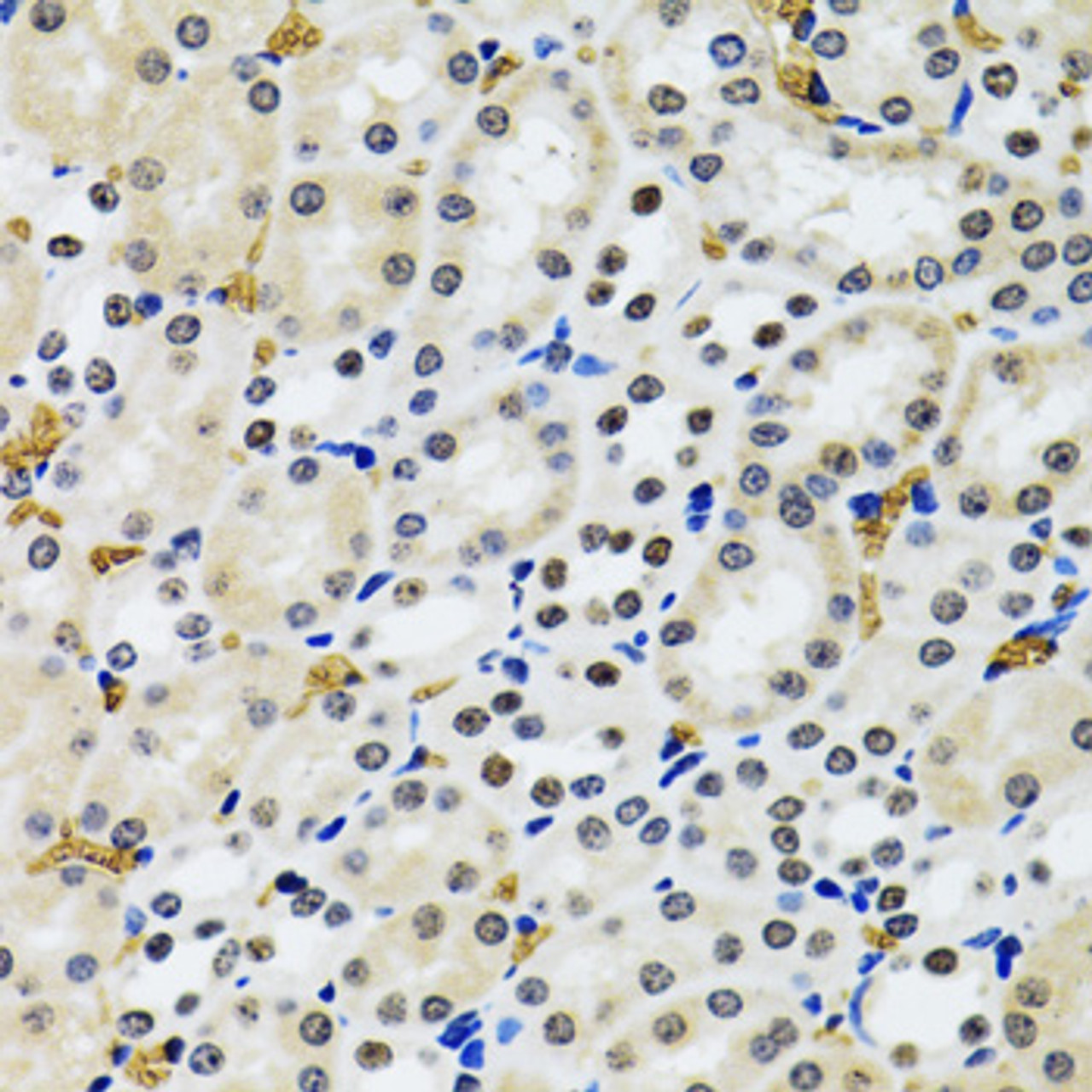Immunohistochemistry of paraffin-embedded rat kidney using 53BP1 antibody (19-839) at dilution of 1:100 (40x lens) .