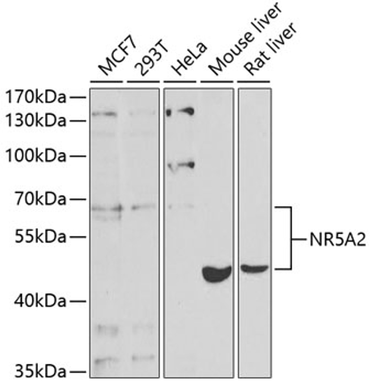 Western blot analysis of extracts of various cell lines, using NR5A2 antibody (19-844) at 1:1000 dilution.<br/>Secondary antibody: HRP Goat Anti-Rabbit IgG (H+L) at 1:10000 dilution.<br/>Lysates/proteins: 25ug per lane.<br/>Blocking buffer: 3% nonfat dry milk in TBST.