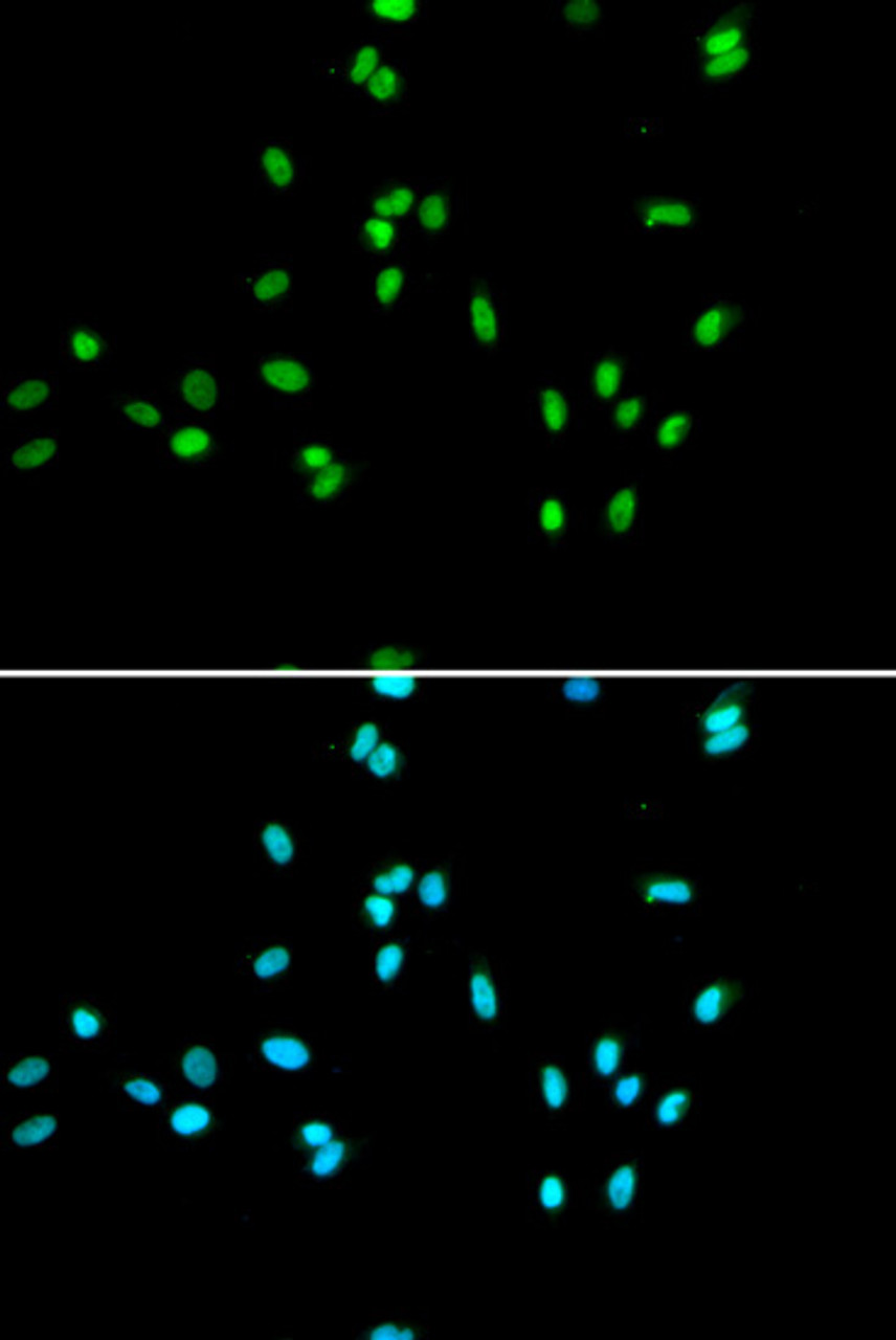 Immunofluorescence analysis of A549 cells using NR5A2 antibody (19-844) . Blue: DAPI for nuclear staining.