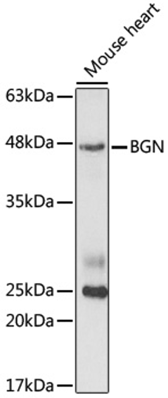 Western blot analysis of extracts of mouse heart cells, using BGN antibody (19-847) at 1:1000 dilution.<br/>Secondary antibody: HRP Goat Anti-Rabbit IgG (H+L) at 1:10000 dilution.<br/>Lysates/proteins: 25ug per lane.<br/>Blocking buffer: 3% nonfat dry milk in TBST.<br/>Detection: ECL Basic Kit.<br/>