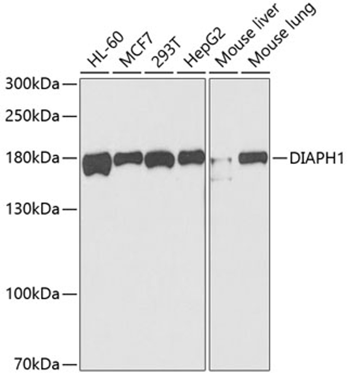 Western blot analysis of extracts of various cell lines, using DIAPH1 antibody (19-849) at 1:1000 dilution.<br/>Secondary antibody: HRP Goat Anti-Rabbit IgG (H+L) at 1:10000 dilution.<br/>Lysates/proteins: 25ug per lane.<br/>Blocking buffer: 3% nonfat dry milk in TBST.<br/>Detection: ECL Basic Kit.<br/>Exposure time: 90s.