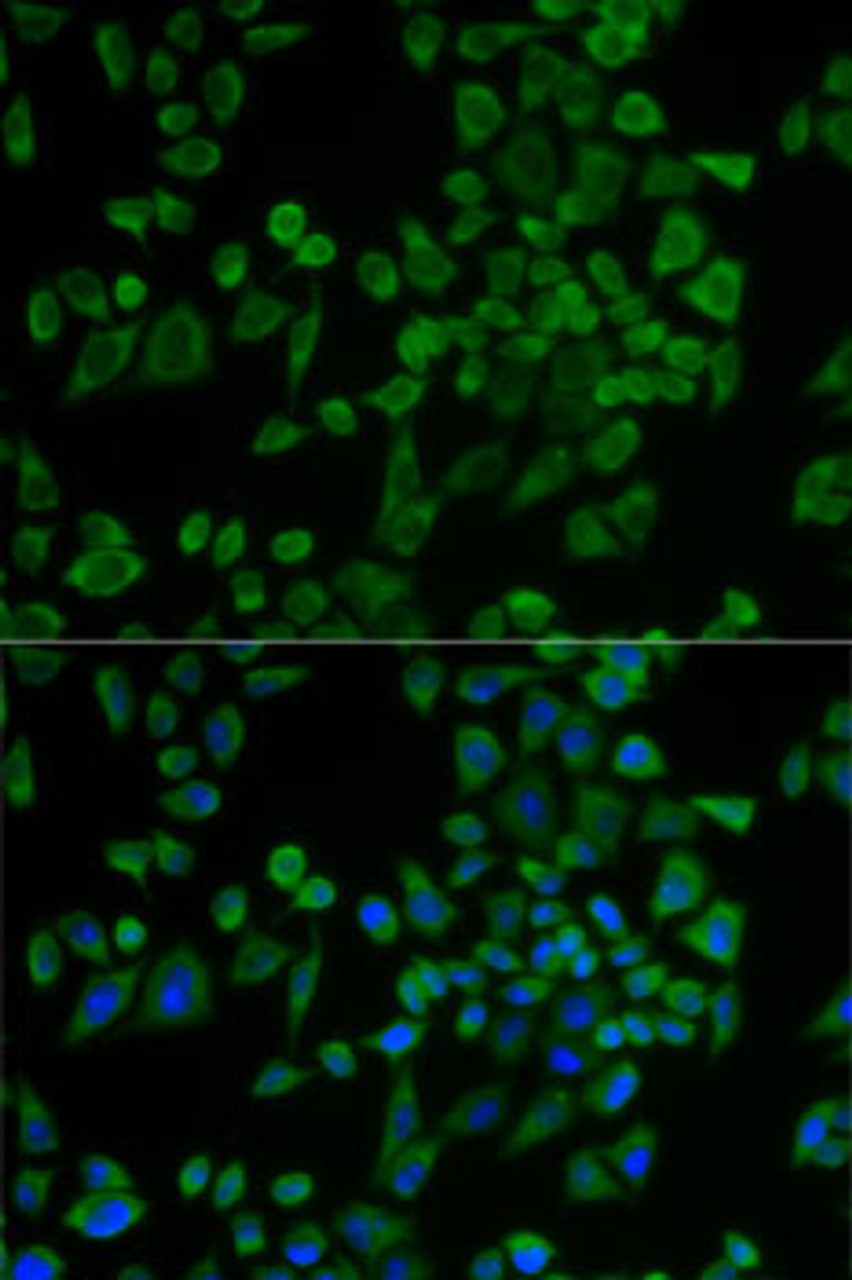 Immunofluorescence analysis of U2OS cells using P2RY2 antibody (19-854) . Blue: DAPI for nuclear staining.