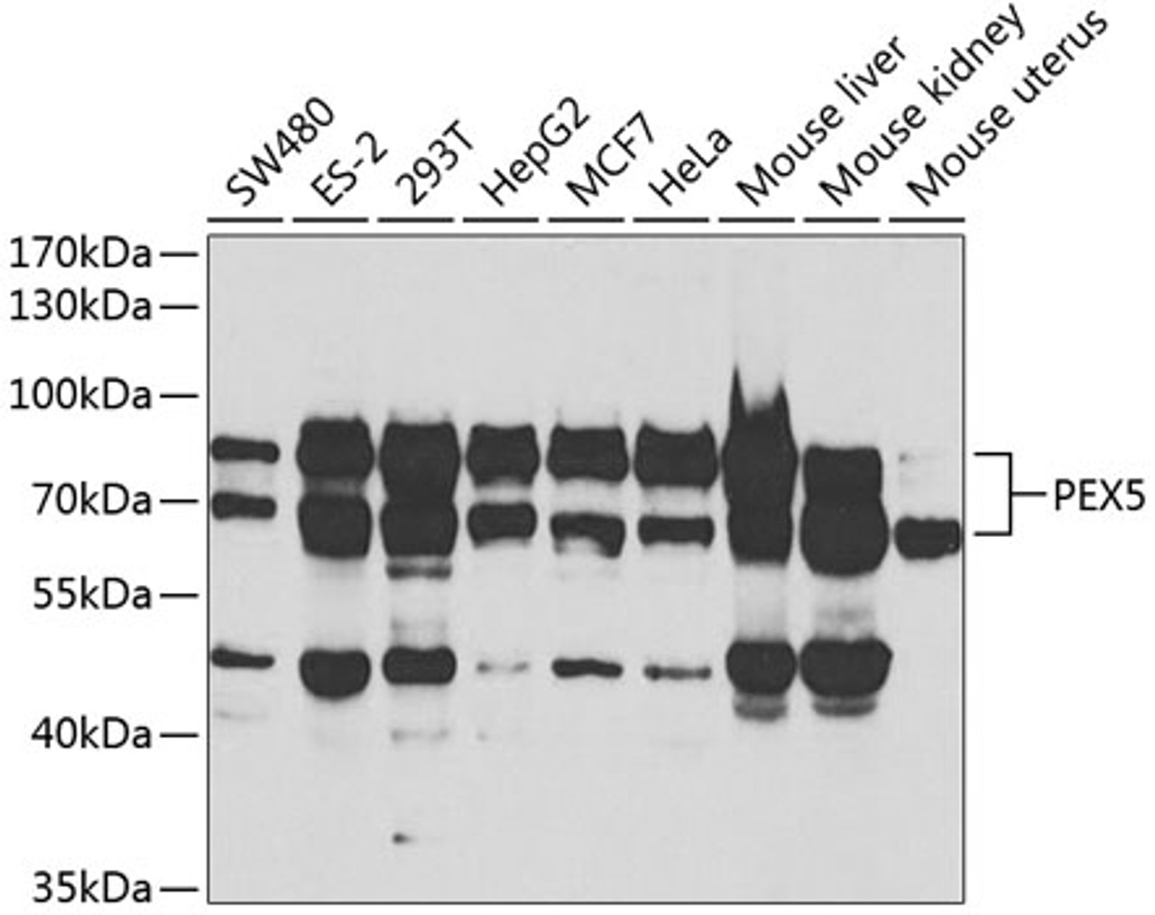 Western blot analysis of extracts of various cell lines, using PEX5 antibody (19-855) at 1:1000 dilution._Secondary antibody: HRP Goat Anti-Rabbit IgG (H+L) at 1:10000 dilution._Lysates/proteins: 25ug per lane._Blocking buffer: 3% nonfat dry milk in TBST._Detection: ECL Basic Kit._Exposure time: 90s.