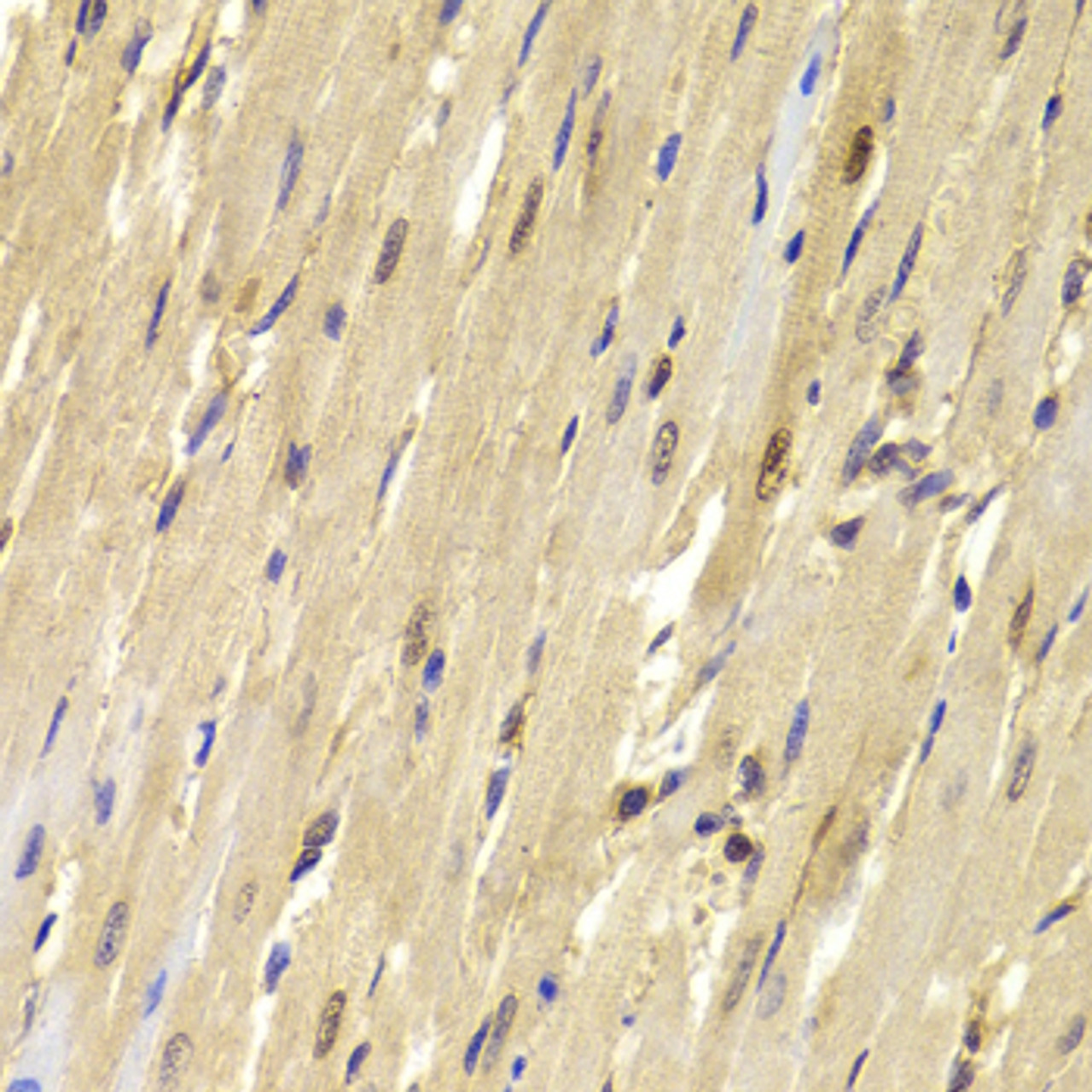 Immunohistochemistry of paraffin-embedded mouse heart using TOPBP1 antibody (19-856) at dilution of 1:100 (40x lens) .