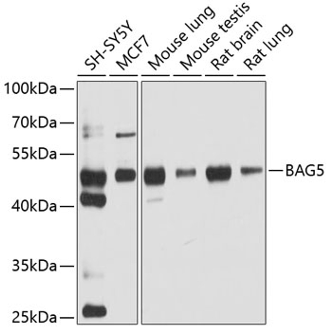 Western blot analysis of extracts of various cell lines, using BAG5 antibody (19-862) at 1:1000 dilution.<br/>Secondary antibody: HRP Goat Anti-Rabbit IgG (H+L) at 1:10000 dilution.<br/>Lysates/proteins: 25ug per lane.<br/>Blocking buffer: 3% nonfat dry milk in TBST.<br/>Detection: ECL Enhanced Kit.<br/>Exposure time: 90s.