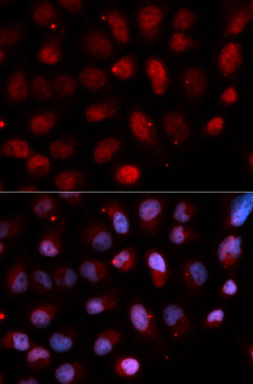 Immunofluorescence analysis of U2OS cells using Pea3 / ETV4 antibody (19-863) . Blue: DAPI for nuclear staining.