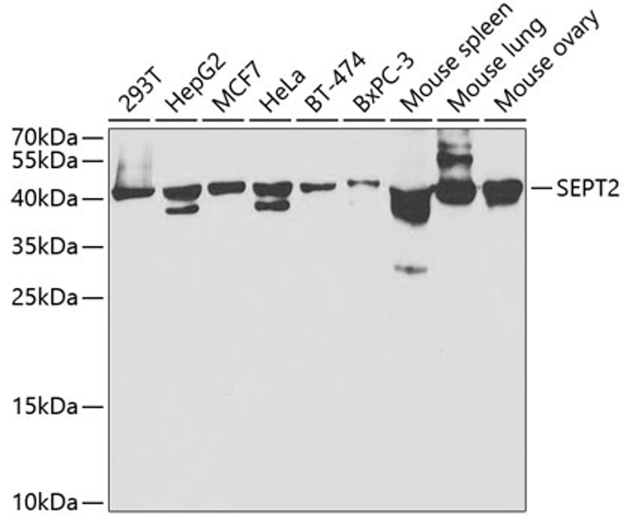 Western blot analysis of extracts of various cell lines, using SEPT2 antibody (19-865) at 1:1000 dilution.<br/>Secondary antibody: HRP Goat Anti-Rabbit IgG (H+L) at 1:10000 dilution.<br/>Lysates/proteins: 25ug per lane.<br/>Blocking buffer: 3% nonfat dry milk in TBST.<br/>Detection: ECL Basic Kit.<br/>Exposure time: 30s.