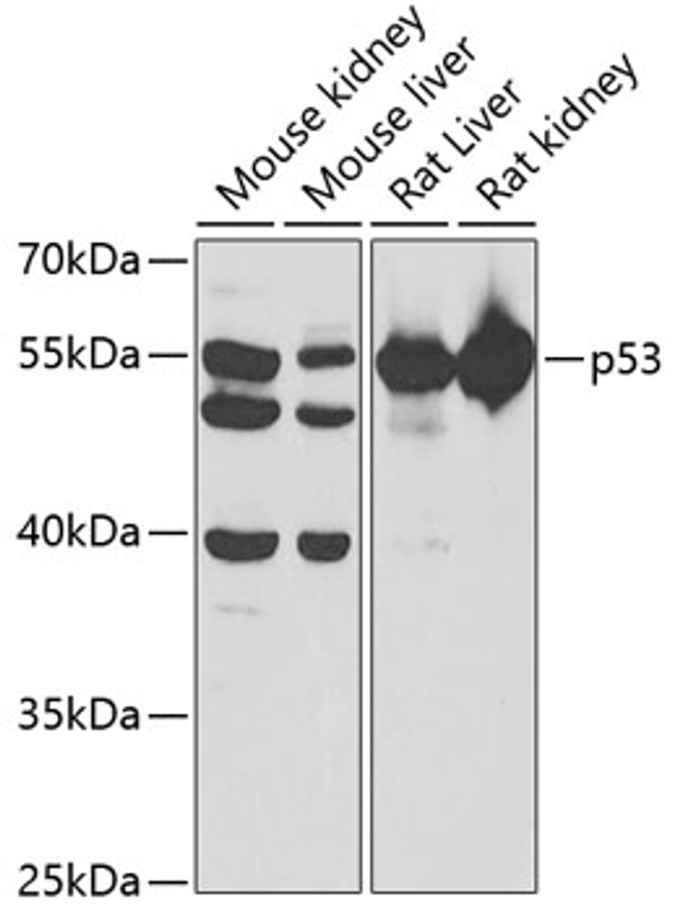 Western blot analysis of extracts of various cell lines, using p53 antibody (19-867) at 1:1000 dilution.<br/>Secondary antibody: HRP Goat Anti-Rabbit IgG (H+L) at 1:10000 dilution.<br/>Lysates/proteins: 25ug per lane.<br/>Blocking buffer: 3% nonfat dry milk in TBST.<br/>Detection: ECL Basic Kit.<br/>Exposure time: 60s.
