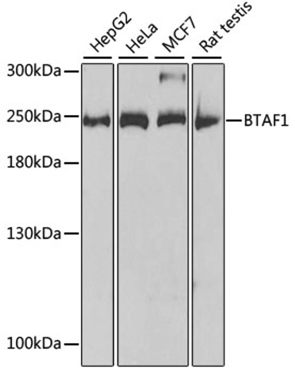 Western blot analysis of extracts of various cell lines, using BTAF1 antibody (19-872) at 1:1000 dilution.<br/>Secondary antibody: HRP Goat Anti-Rabbit IgG (H+L) at 1:10000 dilution.<br/>Lysates/proteins: 25ug per lane.<br/>Blocking buffer: 3% nonfat dry milk in TBST.<br/>Detection: ECL Basic Kit.