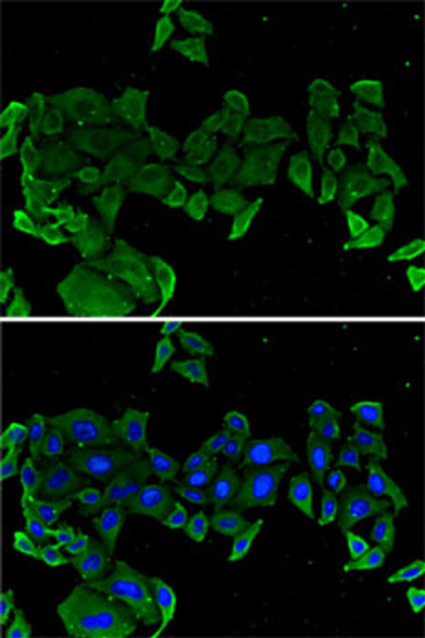 Immunofluorescence analysis of U2OS cells using COMP antibody (19-873) . Blue: DAPI for nuclear staining.