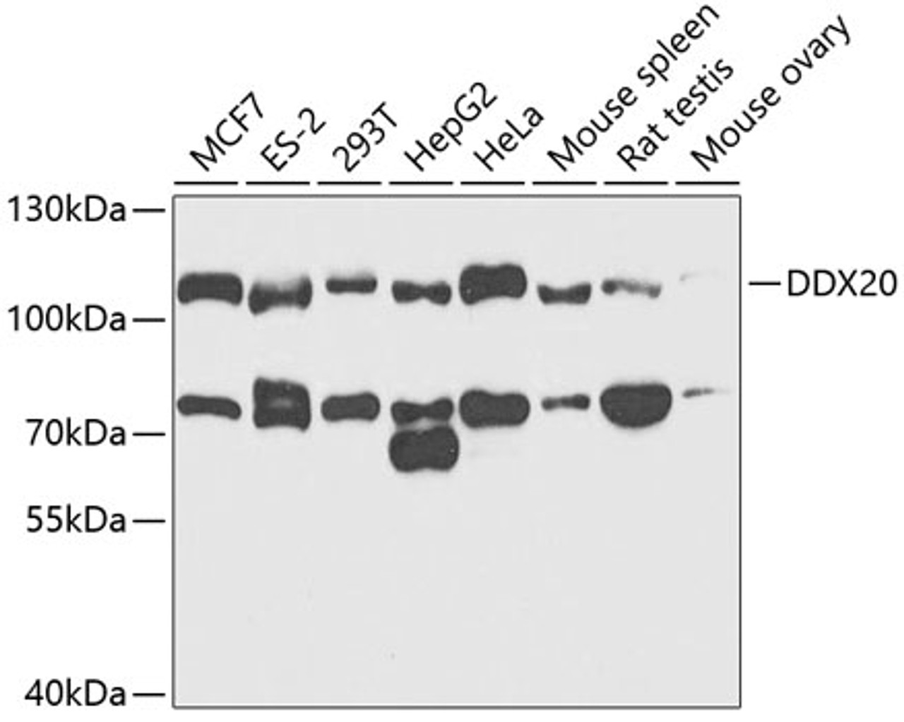 Western blot analysis of extracts of various cell lines, using DDX20 antibody (19-877) at 1:1000 dilution.<br/>Secondary antibody: HRP Goat Anti-Rabbit IgG (H+L) at 1:10000 dilution.<br/>Lysates/proteins: 25ug per lane.<br/>Blocking buffer: 3% nonfat dry milk in TBST.<br/>Detection: ECL Enhanced Kit.<br/>Exposure time: 90s.