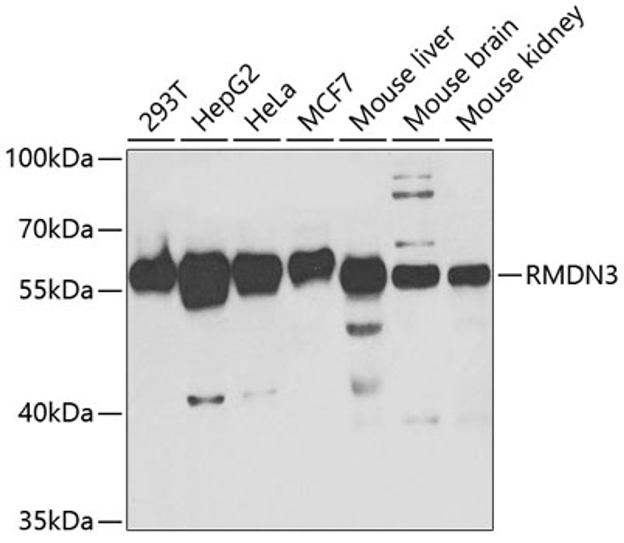 Western blot analysis of extracts of various cell lines, using RMDN3 antibody (19-879) at 1:1000 dilution.<br/>Secondary antibody: HRP Goat Anti-Rabbit IgG (H+L) at 1:10000 dilution.<br/>Lysates/proteins: 25ug per lane.<br/>Blocking buffer: 3% nonfat dry milk in TBST.<br/>Detection: ECL Basic Kit.<br/>Exposure time: 90s.