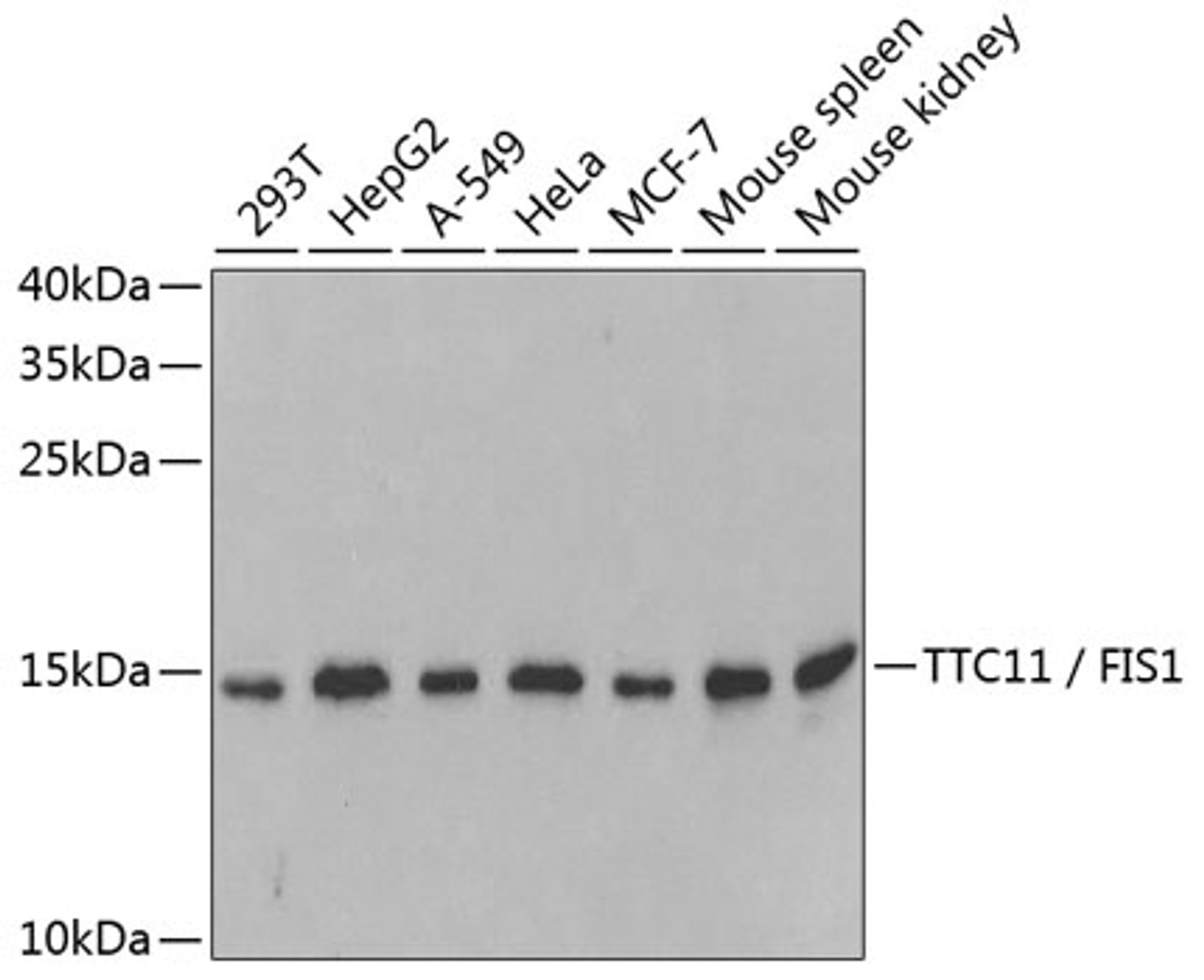 Western blot analysis of extracts of various cell lines, using TTC11 / FIS1 antibody (19-880) at 1:1000 dilution.<br/>Secondary antibody: HRP Goat Anti-Rabbit IgG (H+L) at 1:10000 dilution.<br/>Lysates/proteins: 25ug per lane.<br/>Blocking buffer: 3% nonfat dry milk in TBST.<br/>Detection: ECL Basic Kit.<br/>Exposure time: 180s.