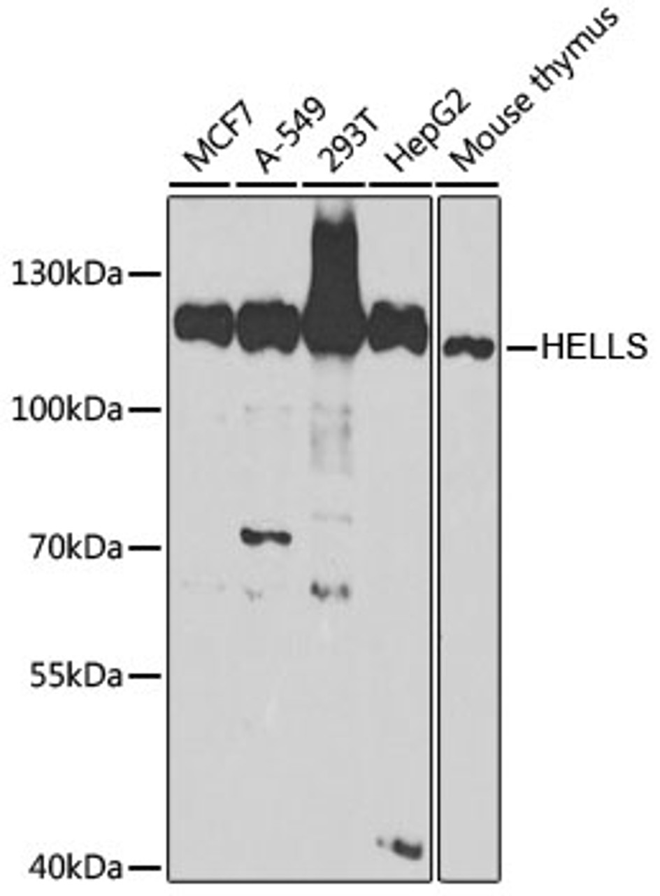 Western blot analysis of extracts of various cell lines, using HELLS antibody (19-887) at 1:1000 dilution.<br/>Secondary antibody: HRP Goat Anti-Rabbit IgG (H+L) at 1:10000 dilution.<br/>Lysates/proteins: 25ug per lane.<br/>Blocking buffer: 3% nonfat dry milk in TBST.<br/>Detection: ECL Basic Kit.<br/>Exposure time: 90s.