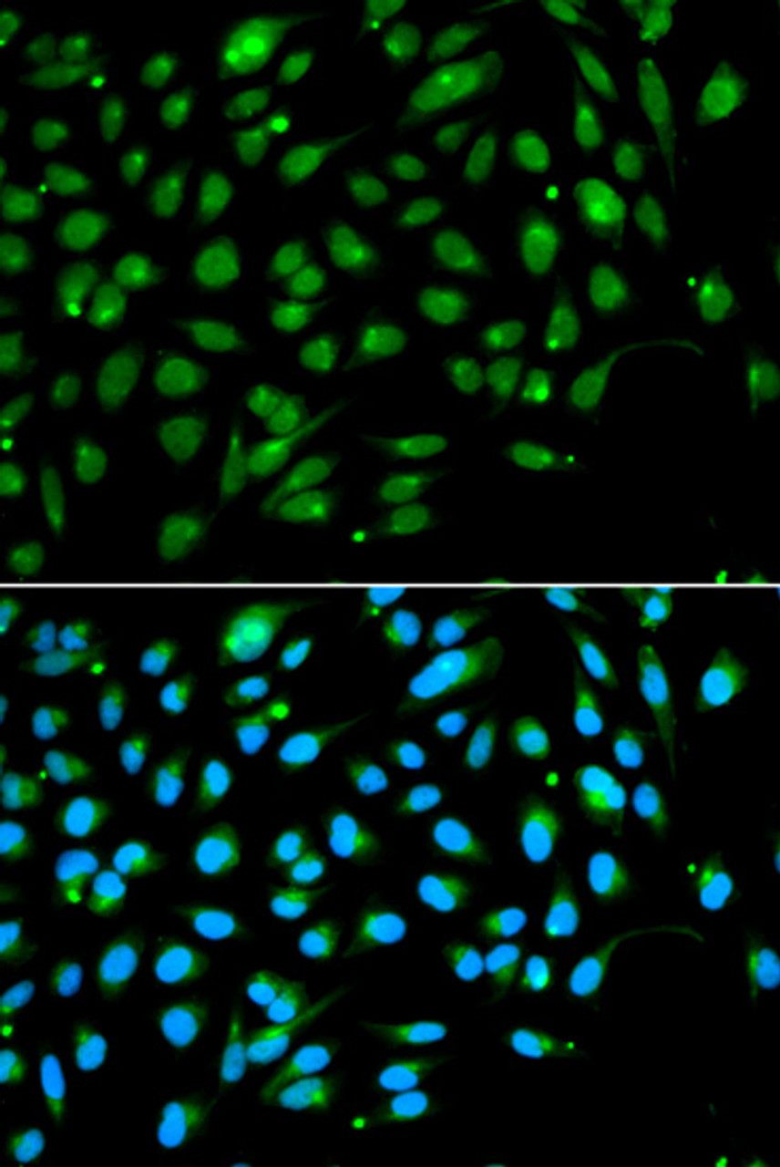 Immunofluorescence analysis of A549 cells using ING3 antibody (19-888) . Blue: DAPI for nuclear staining.