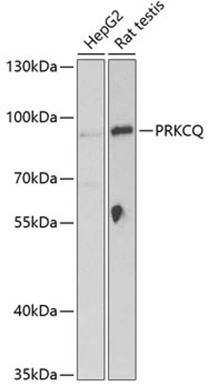 Western blot analysis of extracts of various cell lines, using PRKCQ Antibody (19-889) at 1:1000 dilution.<br/>Secondary antibody: HRP Goat Anti-Rabbit IgG (H+L) at 1:10000 dilution.<br/>Lysates/proteins: 25ug per lane.<br/>Blocking buffer: 3% nonfat dry milk in TBST.<br/>Detection: ECL Basic Kit.<br/>Exposure time: 90s.