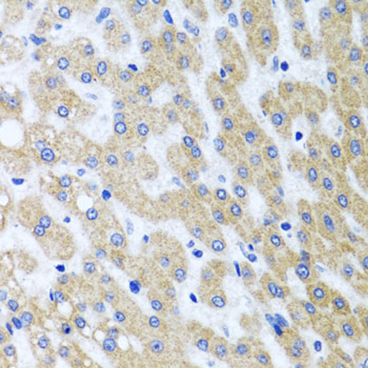 Immunohistochemistry of paraffin-embedded human liver damage using PRMT2 antibody (19-890) at dilution of 1:100 (40x lens) .