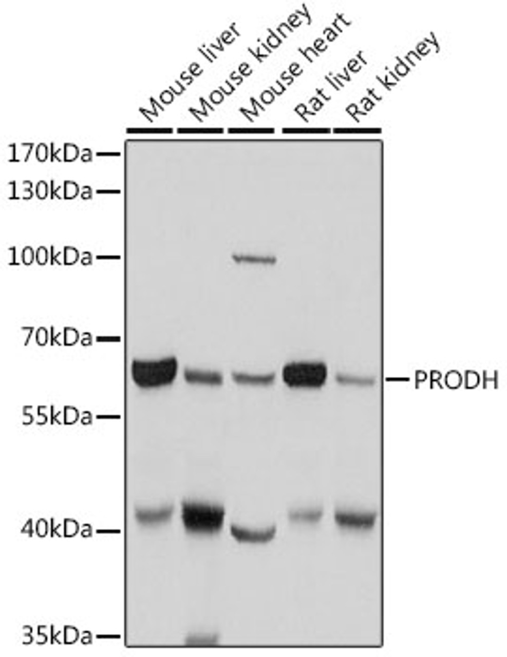 Western blot analysis of extracts of various cell lines, using PRODH antibody (19-891) at 1:1000 dilution.<br/>Secondary antibody: HRP Goat Anti-Mouse IgG (H+L) (AS003) at 1:10000 dilution.<br/>Lysates/proteins: 25ug per lane.<br/>Blocking buffer: 3% nonfat dry milk in TBST.<br/>Detection: ECL Basic Kit.<br/>Exposure time: 1s.