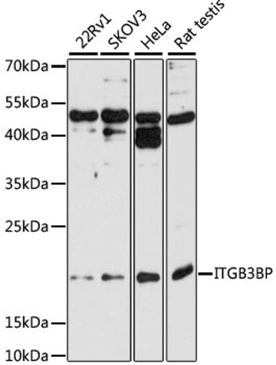 Western blot analysis of extracts of various cell lines, using ITGB3BP antibody (19-892) at 1:1000 dilution.<br/>Secondary antibody: HRP Goat Anti-Rabbit IgG (H+L) at 1:10000 dilution.<br/>Lysates/proteins: 25ug per lane.<br/>Blocking buffer: 3% nonfat dry milk in TBST.<br/>Detection: ECL Basic Kit.<br/>Exposure time: 90s.