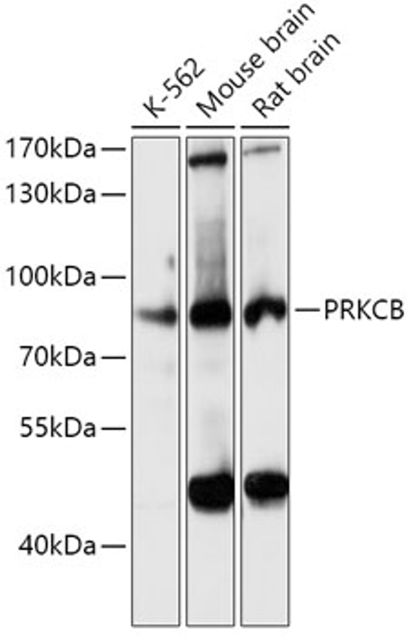 Western blot analysis of extracts of various cell lines, using PRKCB antibody (19-895) at 1:3000 dilution.<br/>Secondary antibody: HRP Goat Anti-Rabbit IgG (H+L) at 1:10000 dilution.<br/>Lysates/proteins: 25ug per lane.<br/>Blocking buffer: 3% nonfat dry milk in TBST.<br/>Detection: ECL Basic Kit.<br/>Exposure time: 10s.