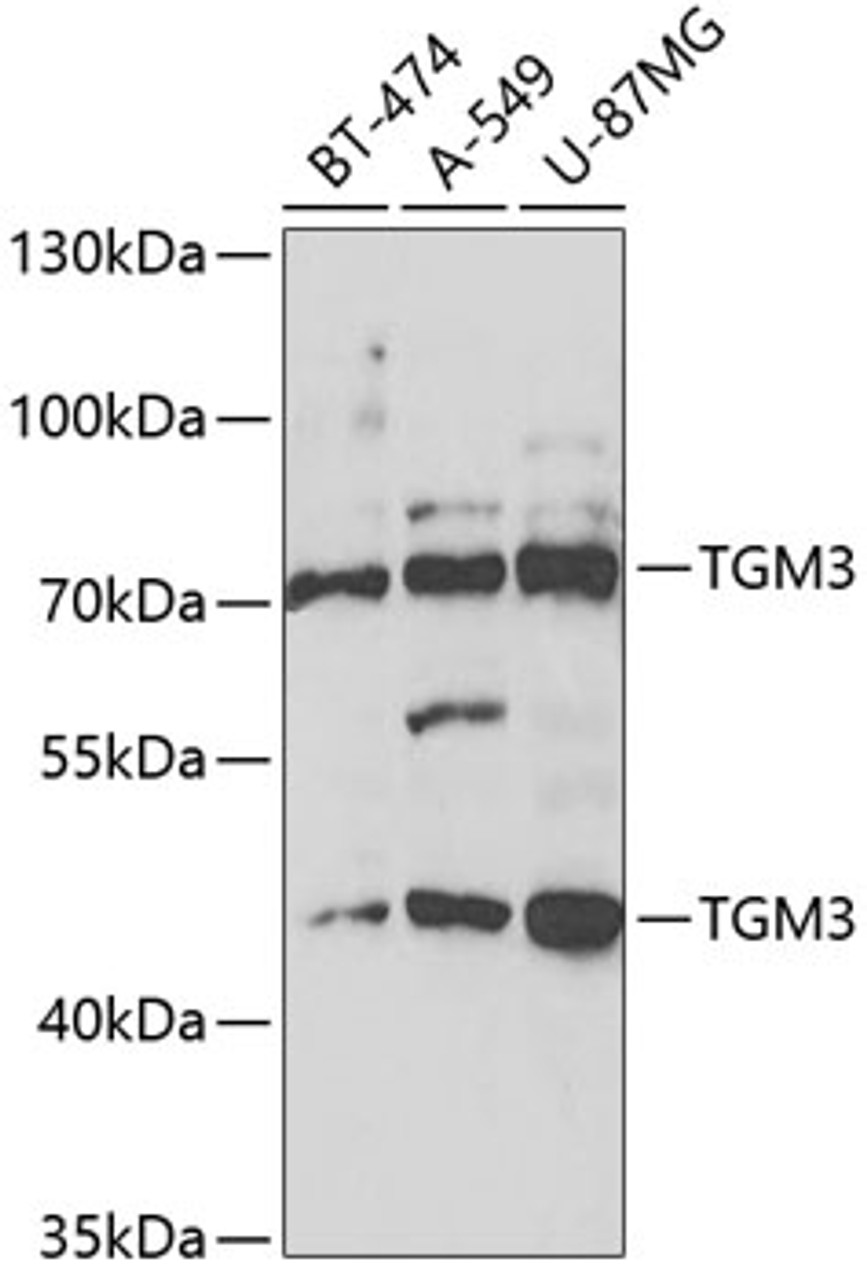 Western blot analysis of extracts of various cell lines, using TGM3 antibody (19-901) at 1:1000 dilution._Secondary antibody: HRP Goat Anti-Rabbit IgG (H+L) at 1:10000 dilution._Lysates/proteins: 25ug per lane._Blocking buffer: 3% nonfat dry milk in TBST._Detection: ECL Enhanced Kit._Exposure time: 50s.