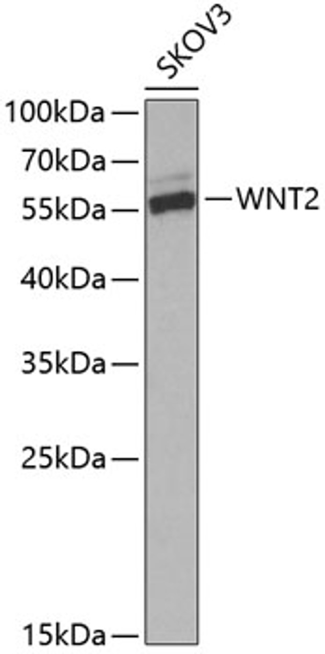 Western blot analysis of extracts of SKOV3 cells, using WNT2 Antibody (19-905) at 1:1000 dilution._Secondary antibody: HRP Goat Anti-Rabbit IgG (H+L) at 1:10000 dilution._Lysates/proteins: 25ug per lane._Blocking buffer: 3% nonfat dry milk in TBST._Detection: ECL Enhanced Kit._Exposure time: 60s.