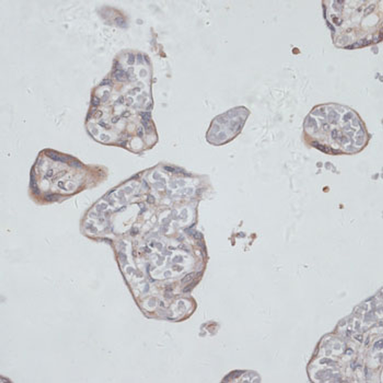 Immunohistochemistry of paraffin-embedded human placenta using TFRC antibody (19-906) at dilution of 1:100 (40x lens) .
