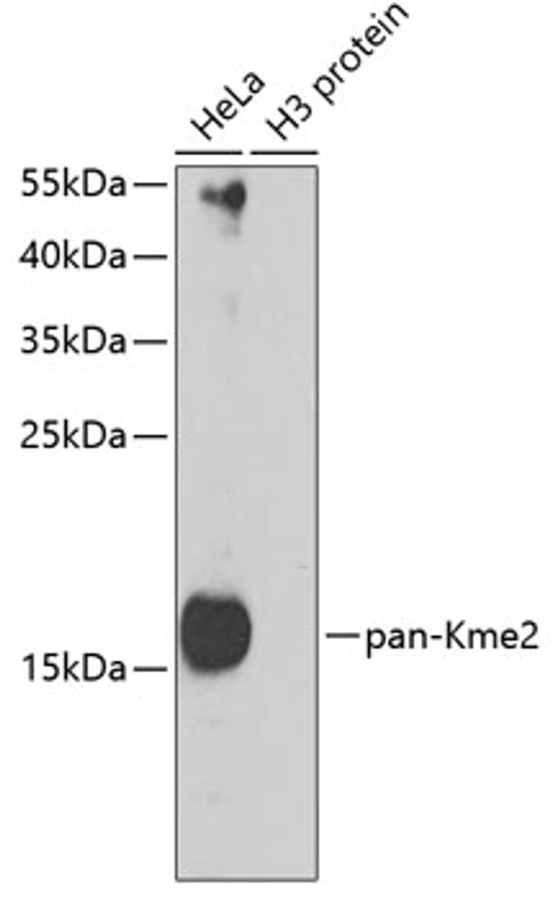 Western blot analysis of extracts of various cell lines, using pan-Kme2 antibody (19-907) at 1:1000 dilution.<br/>Secondary antibody: HRP Goat Anti-Rabbit IgG (H+L) at 1:10000 dilution.<br/>Lysates/proteins: 25ug per lane.<br/>Blocking buffer: 3% nonfat dry milk in TBST.