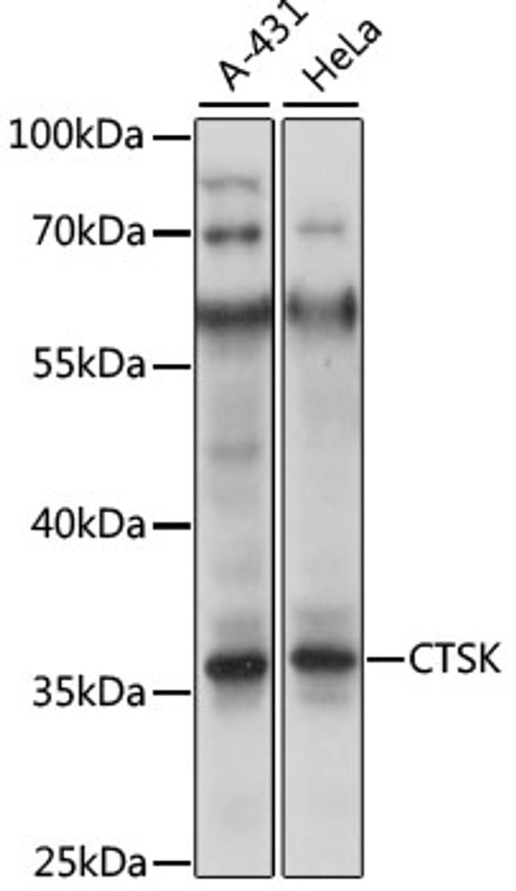 Western blot analysis of extracts of various cell lines, using CTSK antibody (19-908) at 1:1000 dilution.<br/>Secondary antibody: HRP Goat Anti-Rabbit IgG (H+L) at 1:10000 dilution.<br/>Lysates/proteins: 25ug per lane.<br/>Blocking buffer: 3% nonfat dry milk in TBST.<br/>Detection: ECL Enhanced Kit.<br/>Exposure time: 3s.