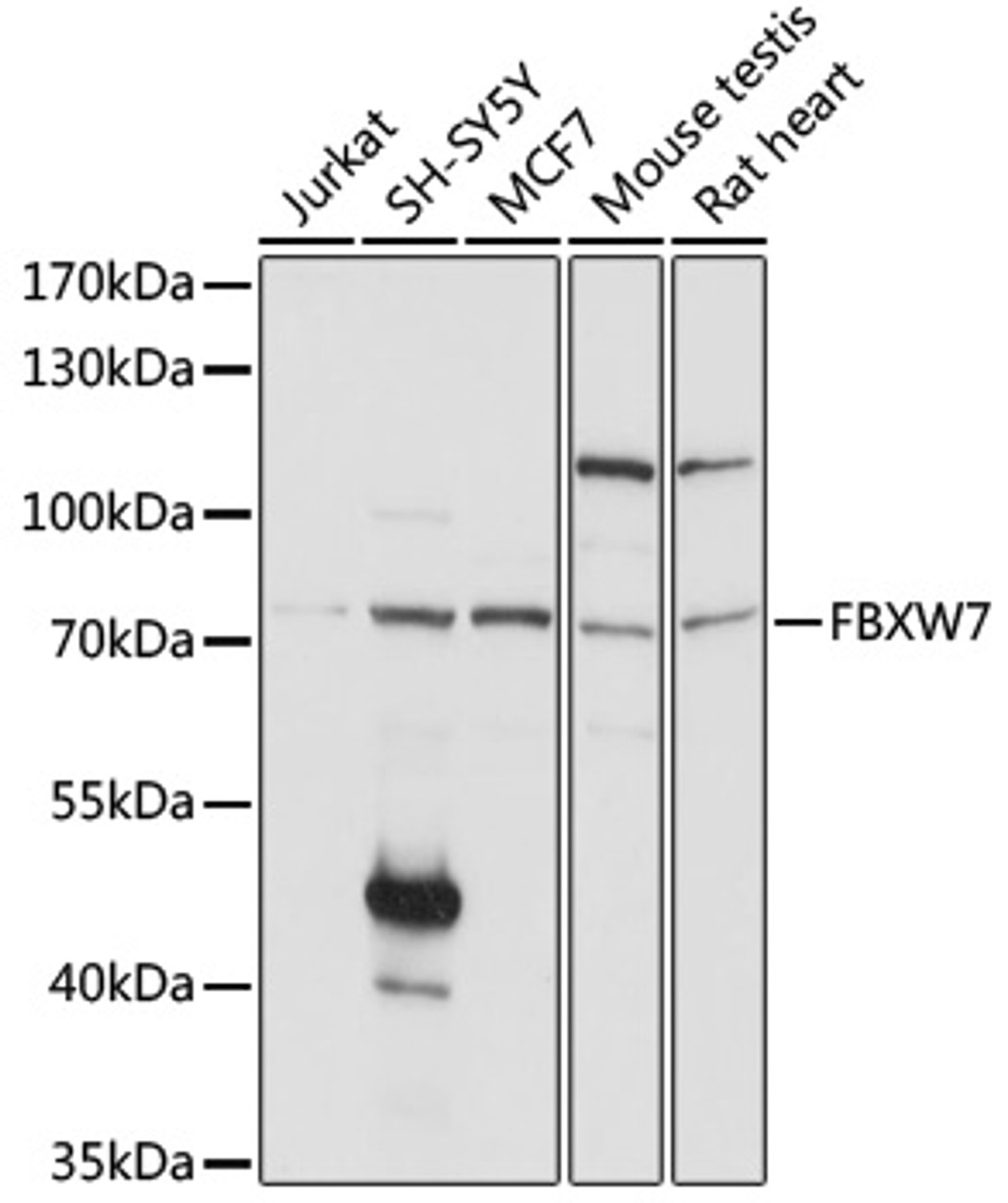 Western blot analysis of extracts of various cell lines, using FBXW7 antibody (19-909) at 1:1000 dilution.<br/>Secondary antibody: HRP Goat Anti-Rabbit IgG (H+L) at 1:10000 dilution.<br/>Lysates/proteins: 25ug per lane.<br/>Blocking buffer: 3% nonfat dry milk in TBST.<br/>Detection: ECL Basic Kit.<br/>Exposure time: 1s.