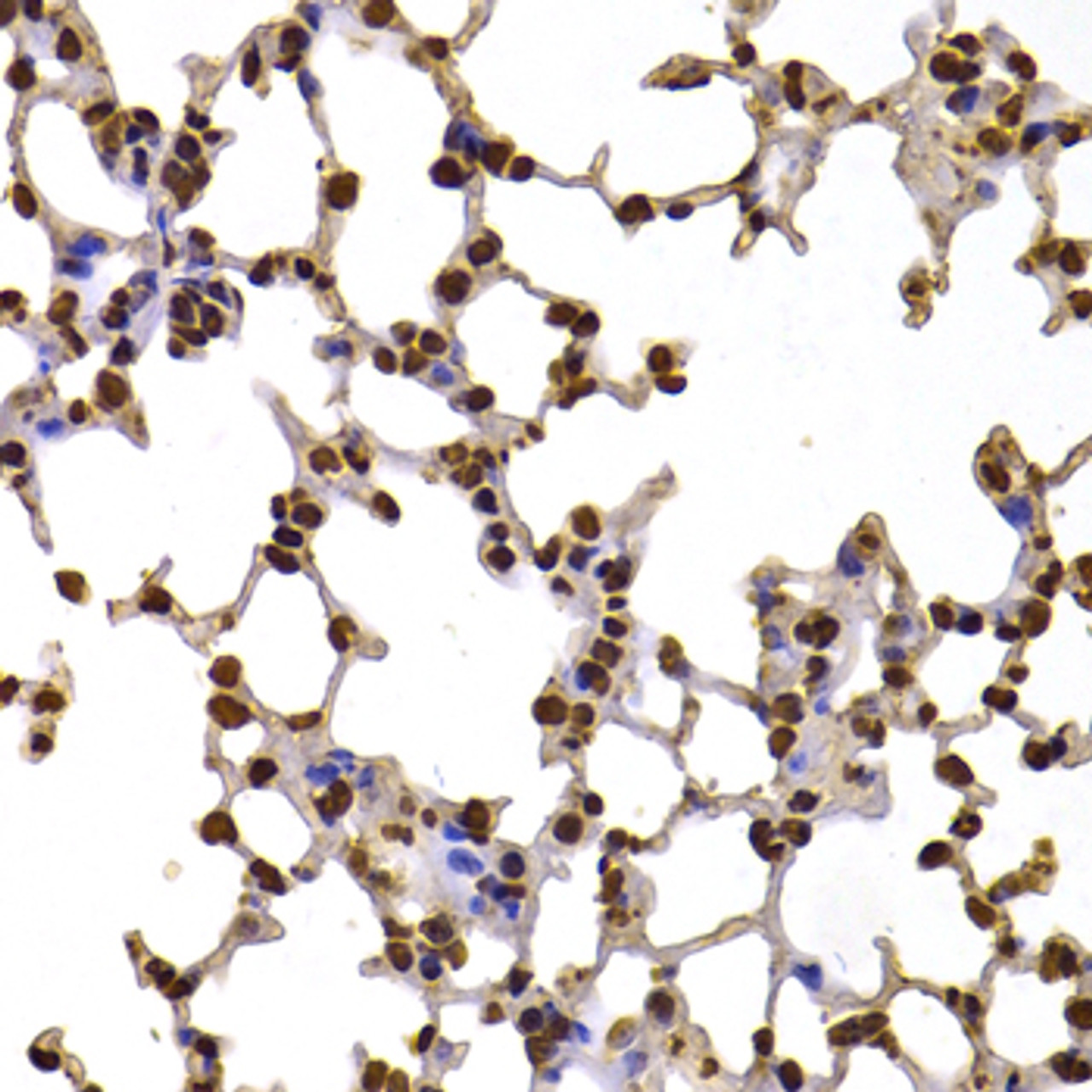 Immunohistochemistry of paraffin-embedded mouse lung using FBXW7 antibody (19-909) at dilution of 1:100 (40x lens) .