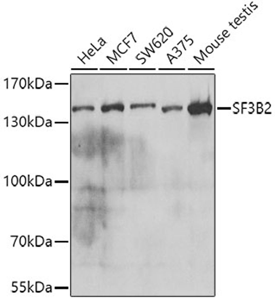 Western blot analysis of extracts of various cell lines, using SF3B2 antibody (19-911) at 1:1000 dilution.<br/>Secondary antibody: HRP Goat Anti-Rabbit IgG (H+L) at 1:10000 dilution.<br/>Lysates/proteins: 25ug per lane.<br/>Blocking buffer: 3% nonfat dry milk in TBST.<br/>Detection: ECL Basic Kit.<br/>Exposure time: 5s.