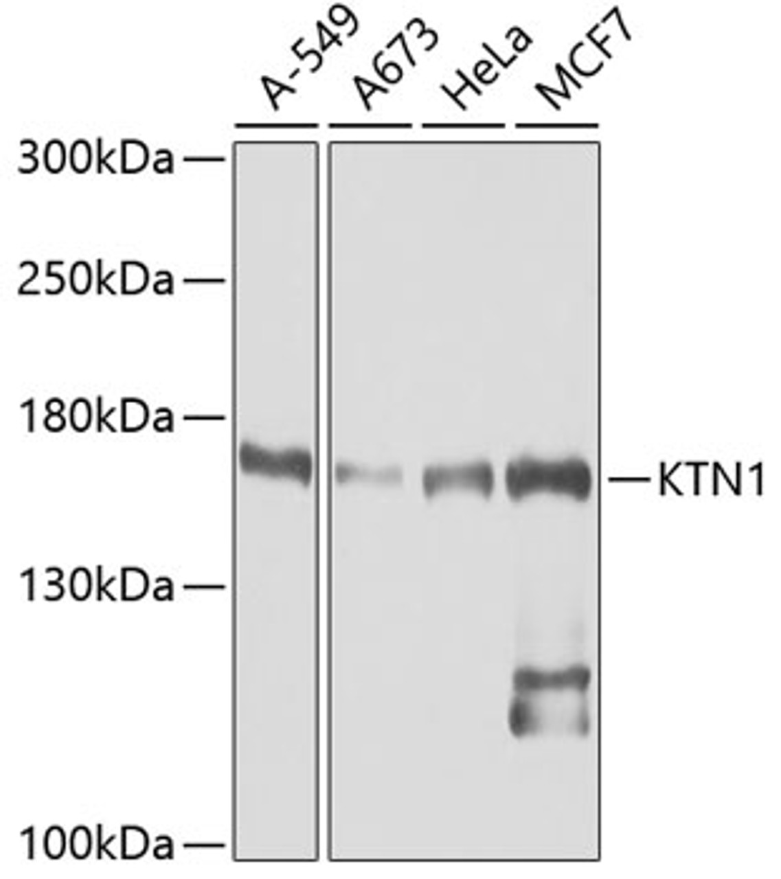 Western blot analysis of extracts of various cell lines, using KTN1 antibody (19-913) at 1:1000 dilution.<br/>Secondary antibody: HRP Goat Anti-Rabbit IgG (H+L) at 1:10000 dilution.<br/>Lysates/proteins: 25ug per lane.<br/>Blocking buffer: 3% nonfat dry milk in TBST.<br/>Detection: ECL Basic Kit.<br/>Exposure time: 90s.