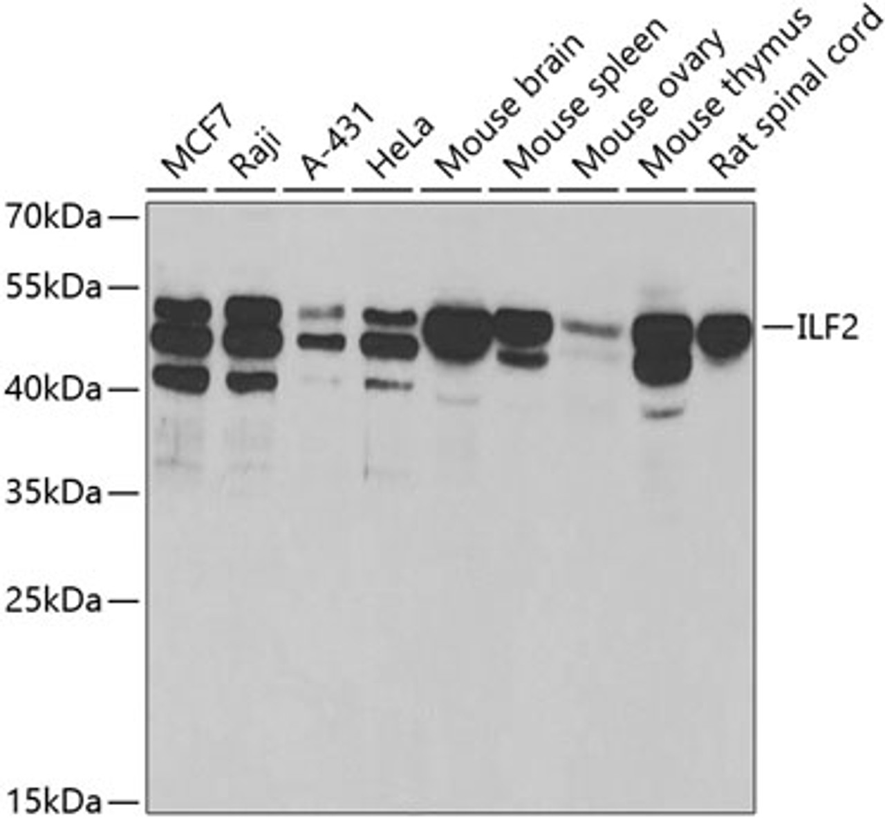 Western blot analysis of extracts of various cell lines, using ILF2 antibody (19-916) at 1:1000 dilution._Secondary antibody: HRP Goat Anti-Rabbit IgG (H+L) at 1:10000 dilution._Lysates/proteins: 25ug per lane._Blocking buffer: 3% nonfat dry milk in TBST._Detection: ECL Basic Kit._Exposure time: 300s.