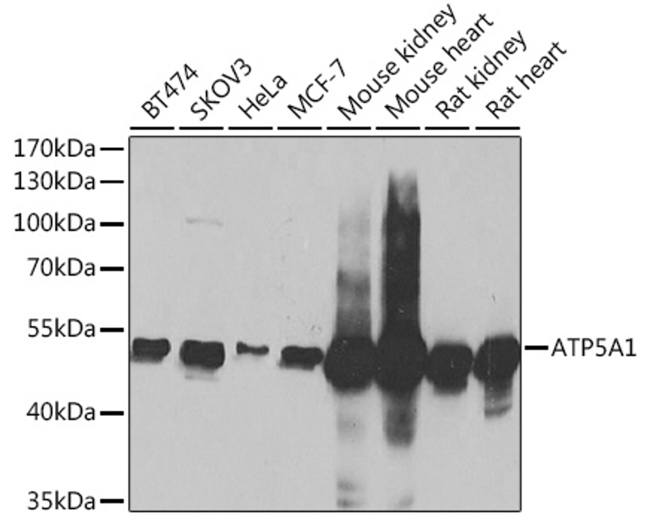 Western blot analysis of extracts of various cell lines, using ATP5A1 Antibody (19-918) at 1:1000 dilution.<br/>Secondary antibody: HRP Goat Anti-Rabbit IgG (H+L) at 1:10000 dilution.<br/>Lysates/proteins: 25ug per lane.<br/>Blocking buffer: 3% nonfat dry milk in TBST.<br/>Detection: ECL Basic Kit.<br/>Exposure time: 1s.