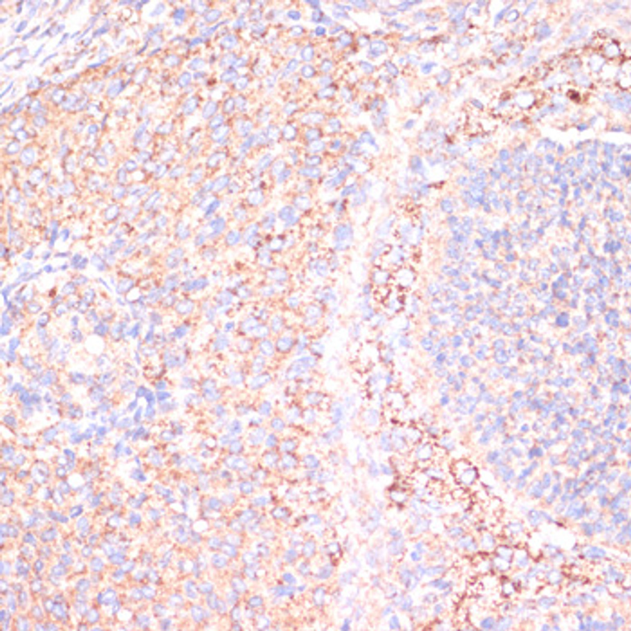 Immunohistochemistry of paraffin-embedded rat ovary using ATP5A1 antibody (19-918) at dilution of 1:100 (40x lens) .