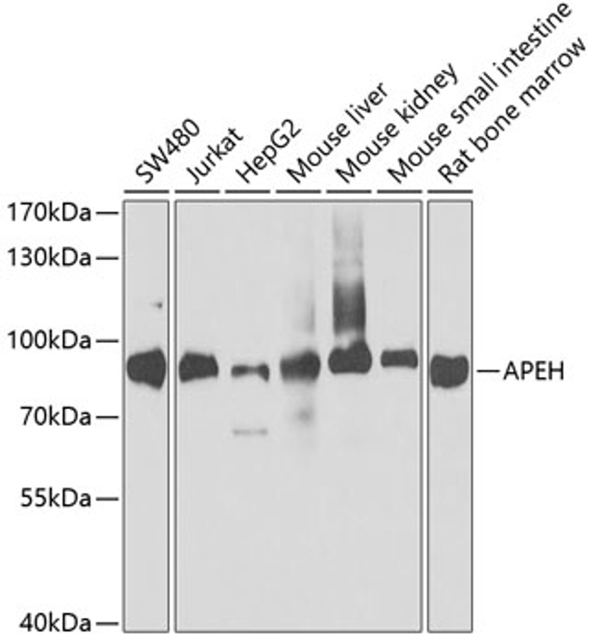 Western blot analysis of extracts of various cell lines, using APEH antibody (19-927) at 1:1000 dilution.<br/>Secondary antibody: HRP Goat Anti-Rabbit IgG (H+L) at 1:10000 dilution.<br/>Lysates/proteins: 25ug per lane.<br/>Blocking buffer: 3% nonfat dry milk in TBST.<br/>Detection: ECL Basic Kit.<br/>Exposure time: 30s.