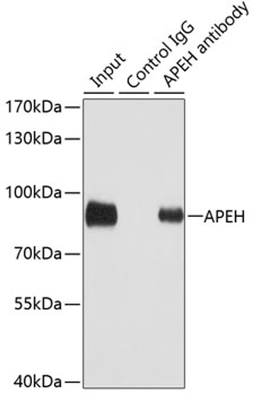 Immunoprecipitation analysis of 100ug extracts of SW480 cells using 3ug APEH antibody (19-927) . Western blot was performed from the immunoprecipitate using APEH antibody (19-927) at a dilition of 1:1000.