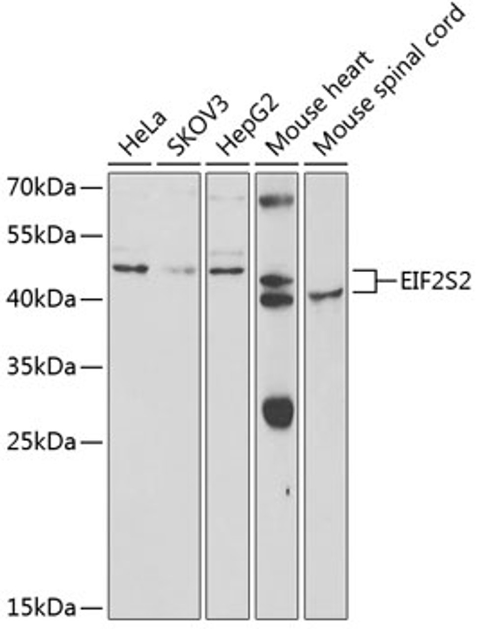 Western blot analysis of extracts of various cell lines, using EIF2S2 antibody (19-928) at 1:1000 dilution.<br/>Secondary antibody: HRP Goat Anti-Rabbit IgG (H+L) at 1:10000 dilution.<br/>Lysates/proteins: 25ug per lane.<br/>Blocking buffer: 3% nonfat dry milk in TBST.<br/>Detection: ECL Basic Kit.<br/>Exposure time: 30s.
