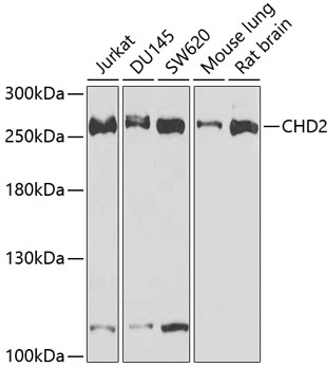 Western blot analysis of extracts of various cell lines, using CHD2 antibody (19-929) at 1:1000 dilution.<br/>Secondary antibody: HRP Goat Anti-Rabbit IgG (H+L) at 1:10000 dilution.<br/>Lysates/proteins: 25ug per lane.<br/>Blocking buffer: 3% nonfat dry milk in TBST.<br/>Detection: ECL Basic Kit.<br/>Exposure time: 30s.