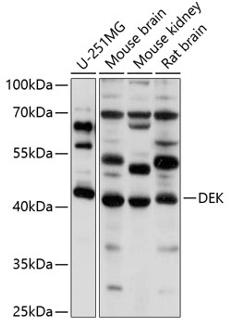 Western blot analysis of extracts of various cell lines, using DEK antibody (19-933) at 1:1000 dilution.<br/>Secondary antibody: HRP Goat Anti-Rabbit IgG (H+L) at 1:10000 dilution.<br/>Lysates/proteins: 25ug per lane.<br/>Blocking buffer: 3% nonfat dry milk in TBST.<br/>Detection: ECL Basic Kit.<br/>Exposure time: 1s.