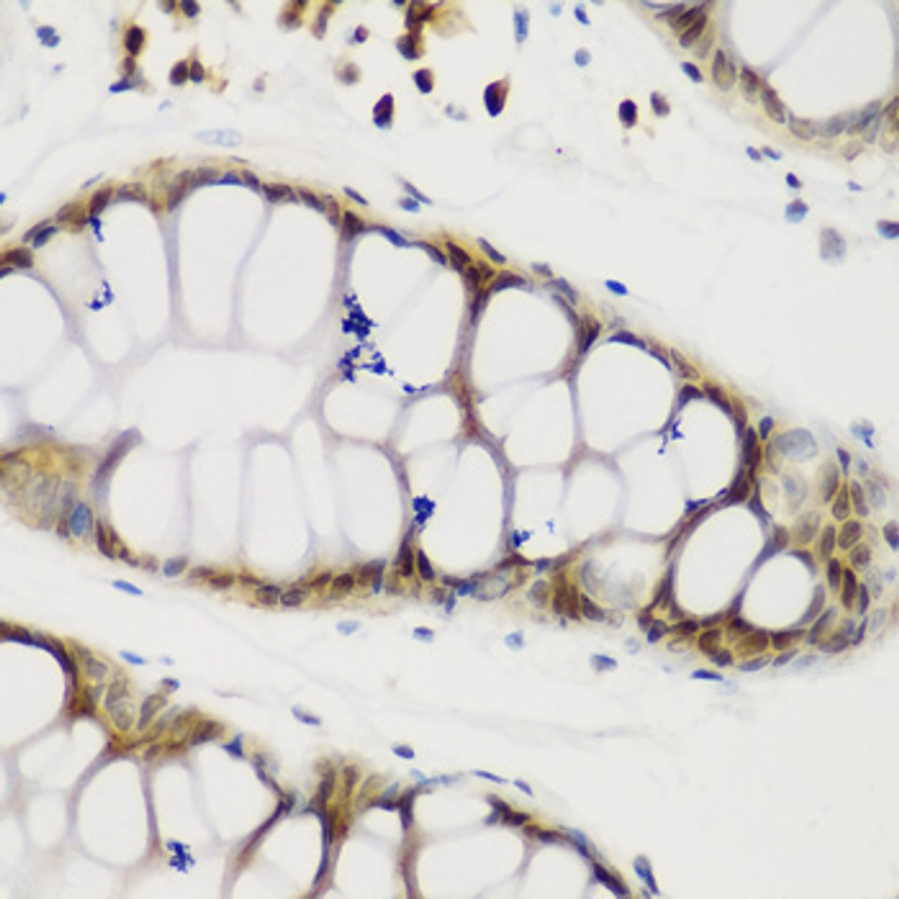 Immunohistochemistry of paraffin-embedded human gastric using NCL antibody (19-935) at dilution of 1:200 (40x lens) .