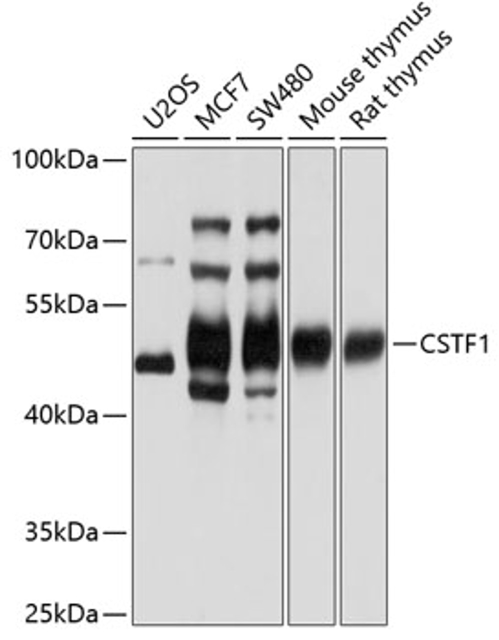 Western blot analysis of extracts of various cell lines, using CSTF1 antibody (19-939) at 1:1000 dilution.<br/>Secondary antibody: HRP Goat Anti-Rabbit IgG (H+L) at 1:10000 dilution.<br/>Lysates/proteins: 25ug per lane.<br/>Blocking buffer: 3% nonfat dry milk in TBST.<br/>Detection: ECL Basic Kit.<br/>Exposure time: 1s.