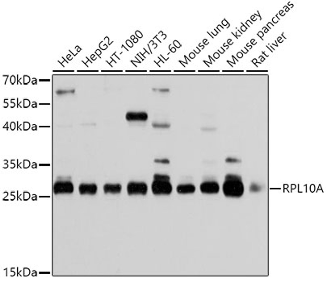 Western blot analysis of extracts of various cell lines, using RPL10A antibody (19-947) at 1:1000 dilution.<br/>Secondary antibody: HRP Goat Anti-Rabbit IgG (H+L) at 1:10000 dilution.<br/>Lysates/proteins: 25ug per lane.<br/>Blocking buffer: 3% nonfat dry milk in TBST.<br/>Detection: ECL Basic Kit.<br/>Exposure time: 10s.