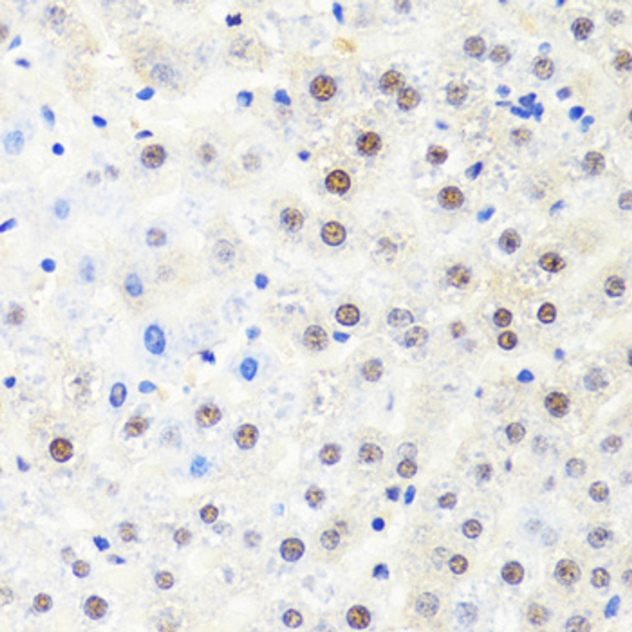 Immunohistochemistry of paraffin-embedded rat liver using POLR2B antibody (19-948) at dilution of 1:100 (40x lens) .