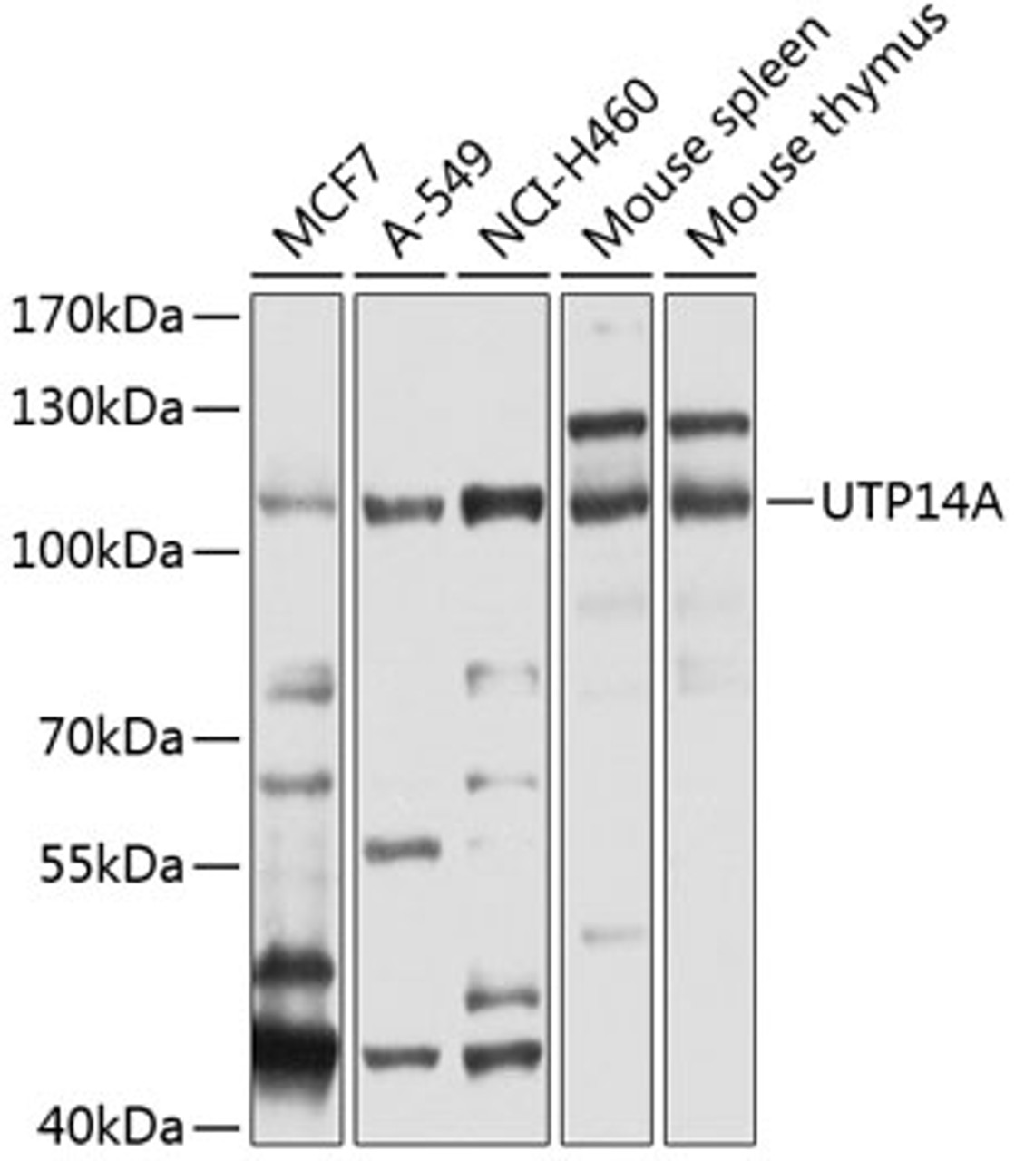 Western blot analysis of extracts of various cell lines, using UTP14A antibody (19-960) at 1:1000 dilution.<br/>Secondary antibody: HRP Goat Anti-Rabbit IgG (H+L) at 1:10000 dilution.<br/>Lysates/proteins: 25ug per lane.<br/>Blocking buffer: 3% nonfat dry milk in TBST.<br/>Detection: ECL Basic Kit.<br/>Exposure time: 30s.