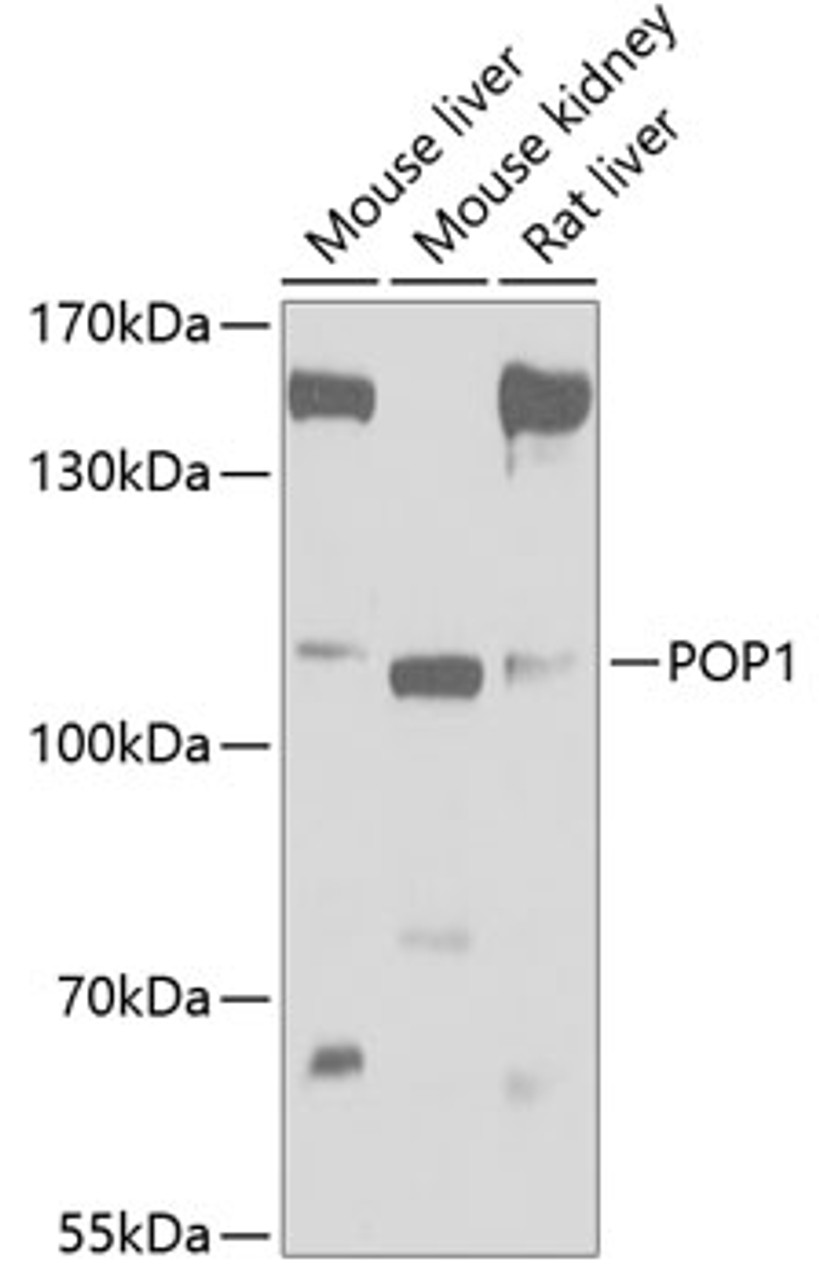 Western blot analysis of extracts of various cell lines, using POP1 antibody (19-961) at 1:1000 dilution.<br/>Secondary antibody: HRP Goat Anti-Rabbit IgG (H+L) at 1:10000 dilution.<br/>Lysates/proteins: 25ug per lane.<br/>Blocking buffer: 3% nonfat dry milk in TBST.<br/>Detection: ECL Basic Kit.<br/>Exposure time: 5s.