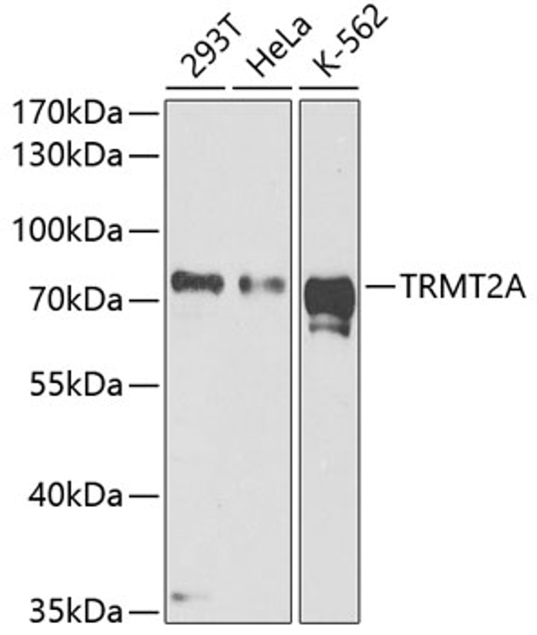 Western blot analysis of extracts of various cell lines, using TRMT2A antibody (19-966) at 1:1000 dilution.<br/>Secondary antibody: HRP Goat Anti-Rabbit IgG (H+L) at 1:10000 dilution.<br/>Lysates/proteins: 25ug per lane.<br/>Blocking buffer: 3% nonfat dry milk in TBST.<br/>Detection: ECL Enhanced Kit.<br/>Exposure time: 90s.